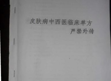 皮肤病中西医制剂药方