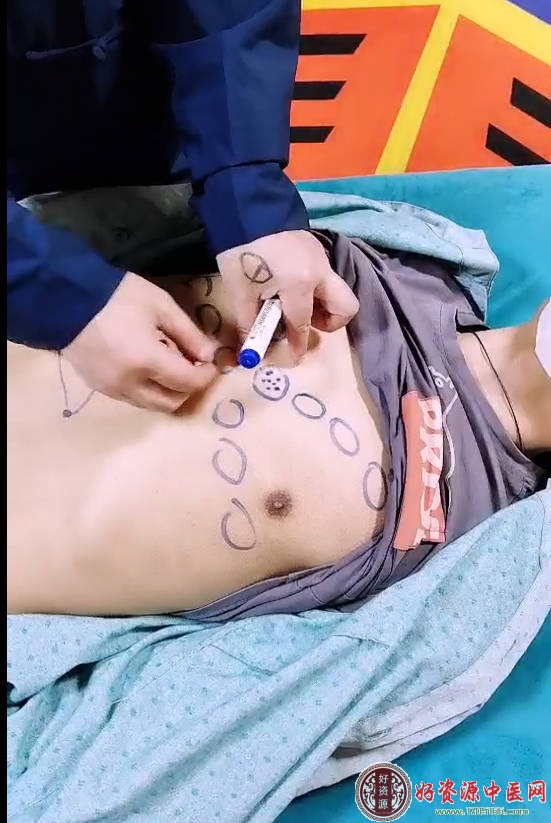 道医绝技一招灵