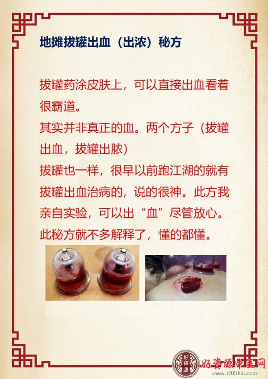 地摊拔罐出血（出浓）秘方