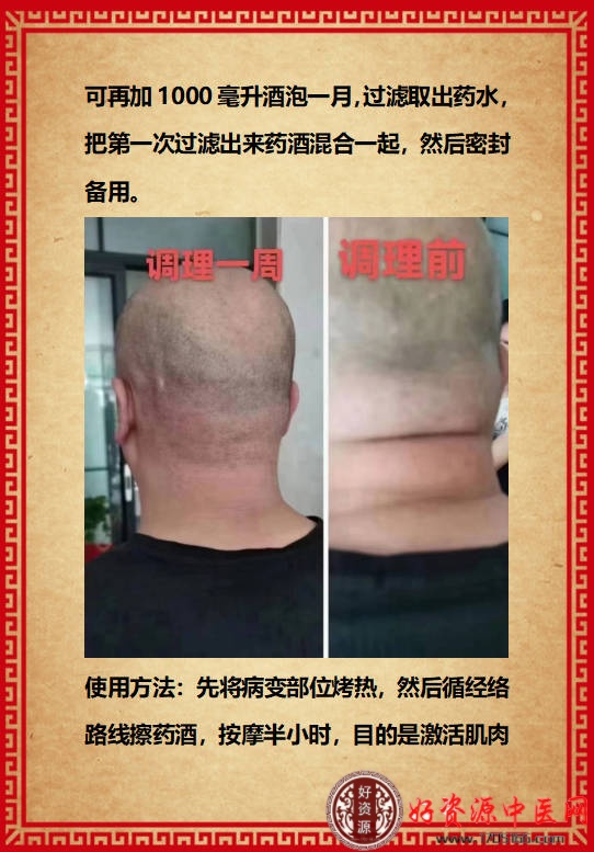 中药通络外包药酒